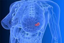 Các bệnh ung thư dễ gặp ở cơ quan sinh sản nữ